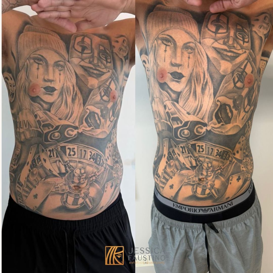 Antes e Depois Enzimas - Caso 3